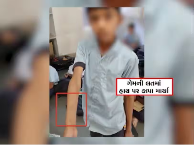 અમરેલીના મોટા મુંજિયાસરમાં ગેમની લતમાં 40 વિદ્યાર્થીઓએ હાથ પર કાપા માર્યા, શિક્ષણ જગતમાં ખળભળાટ;